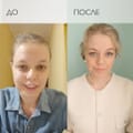 ДО и ПОСЛЕ. Имидж врача-изгоя
