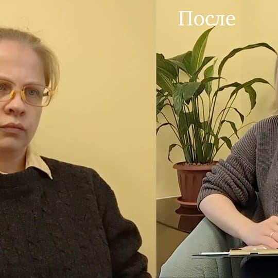 Преображение. До и После
