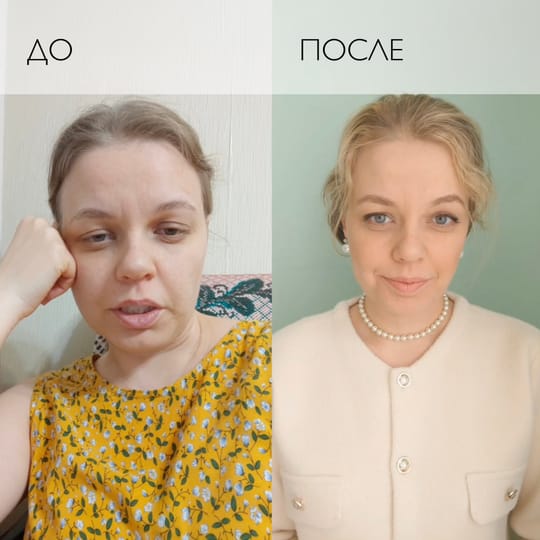 ДО и ПОСЛЕ. Имидж врача-изгоя